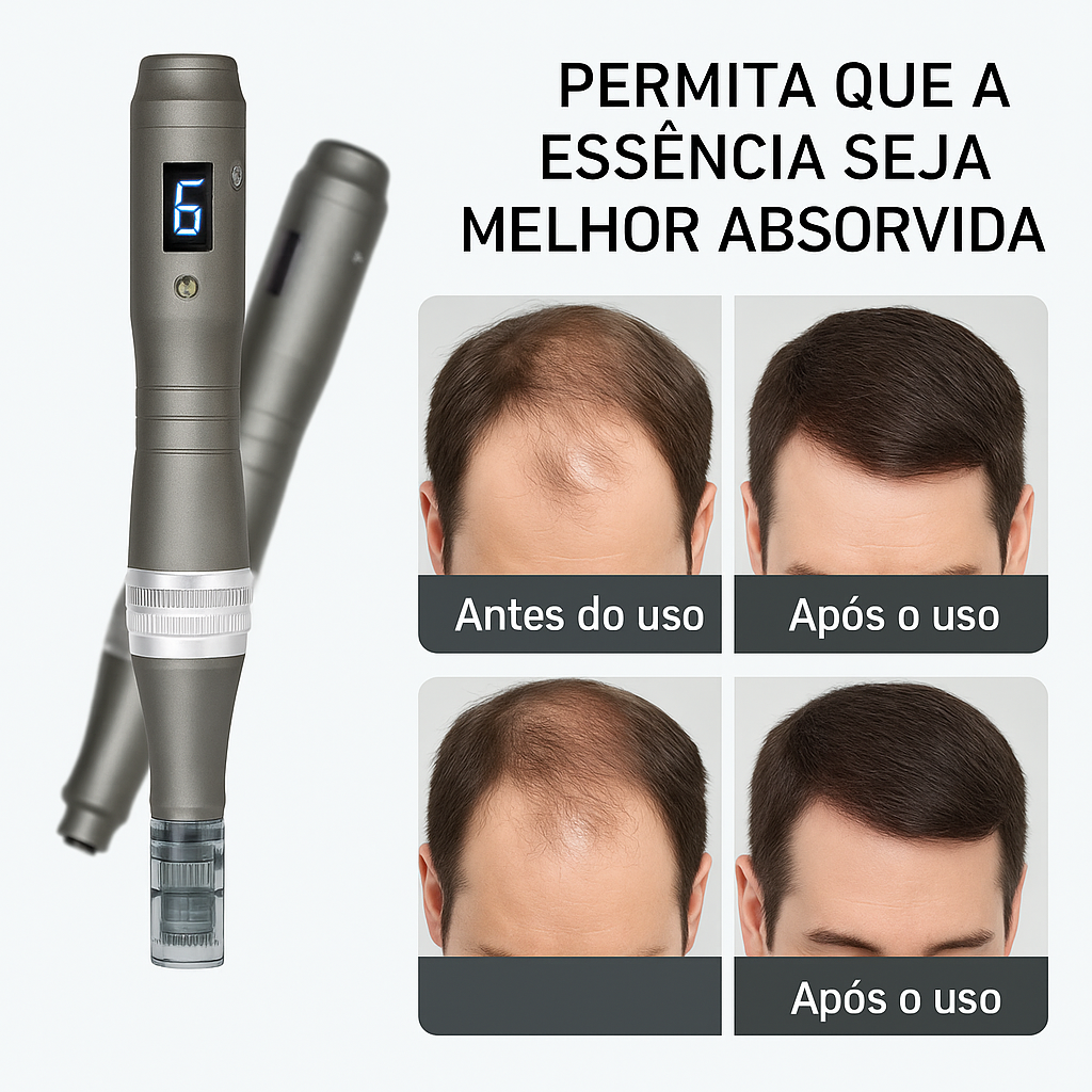 Dr. Pen Ultima M8 Profissional – O Microneedling que Revolucionou a Estética Moderna com Precisão, Tecnologia e Resultados Reais