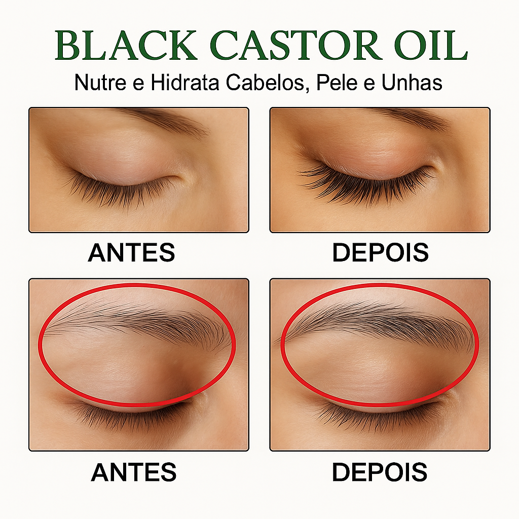 Black Castor Oil 60ml — Crescimento Acelerado e Fortalecimento Profundo dos Fios