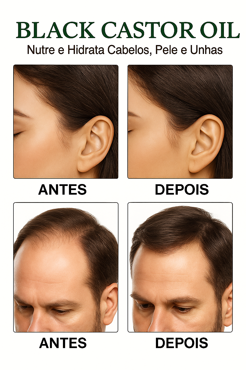 Black Castor Oil 60ml — Crescimento Acelerado e Fortalecimento Profundo dos Fios
